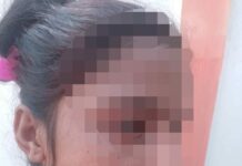 शौच के लिए घर से बाहर निकली बेटी के साथ हुआ रेप, चार दिन बाद तक नही हुआ मेडिकल टेस्ट