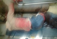 अनियंत्रित आटो चालक ने पिता सहित दो पुत्रियों को रौंदा