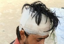 कालेज से लौट रहे युवक पर जानलेवा हमला 24घंटे बाद भी आरोपी गिरफ्त से बाहर