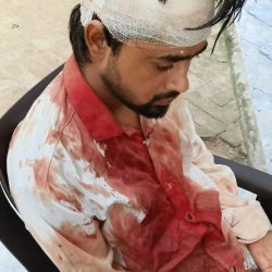 कालेज से लौट रहे युवक पर जानलेवा हमला 24घंटे बाद भी आरोपी गिरफ्त से बाहर