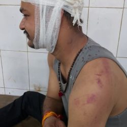 सुल्तानपुर में खाकी पर हमला!दुर्गा विसर्जन कार्यक्रम के दौरान डीजे की आवाज कम करने को कहने पर कांस्टेबल को लाठी-डंडों से पीटा